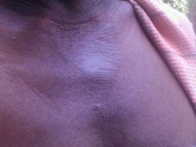 தோல் வியாதிகள் தோல் வியாதிகள்