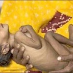மருத்துவத் துறையைச் சீரழிக்கும் தனியார் மய வைரஸ் !