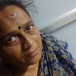 tasmac-struggle-injured-sathya-2
