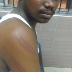 tasmac-struggle-injured-youth-2
