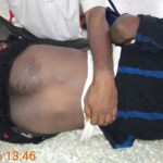 tasmac-struggle-maduravoyal-injured-1