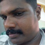 tasmac-struggle-maduravoyal-injured-4