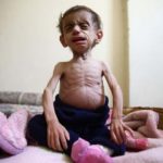 A Picture and its Story: ‘At the doors of starvation:’ siege chokes Damascus suburbs
