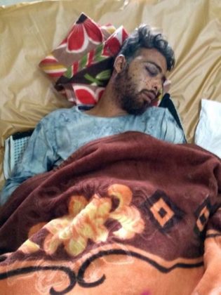 Pellet-gun-victim-SMS-hospital