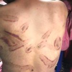 Torture-cry-in-Kashmir-03