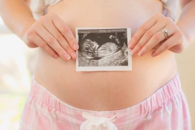 woman holding sonogram over pregnant belly