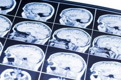 traumatic-brain-injury