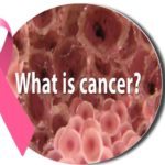 cancer