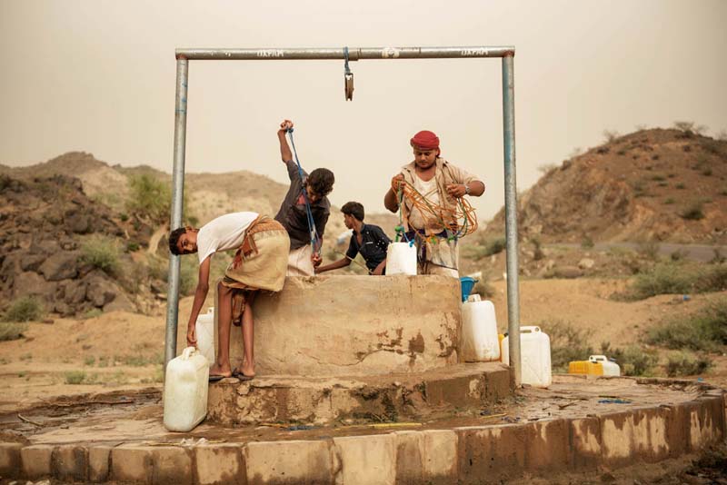 Malnutrition-cholera-Yemen-woes
