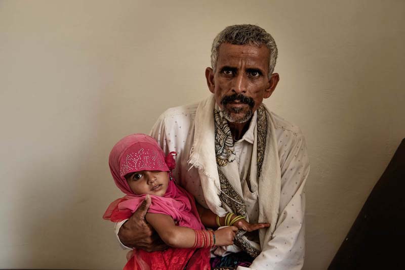 Malnutrition-cholera-Yemen-woes