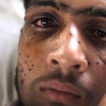 Pellet-victims