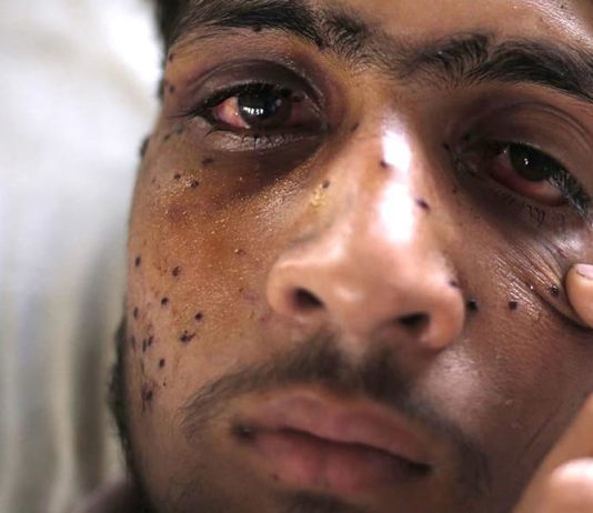 Pellet-victims