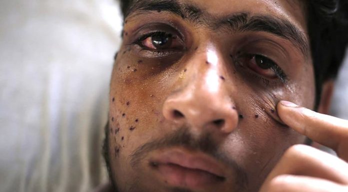 Pellet-victims