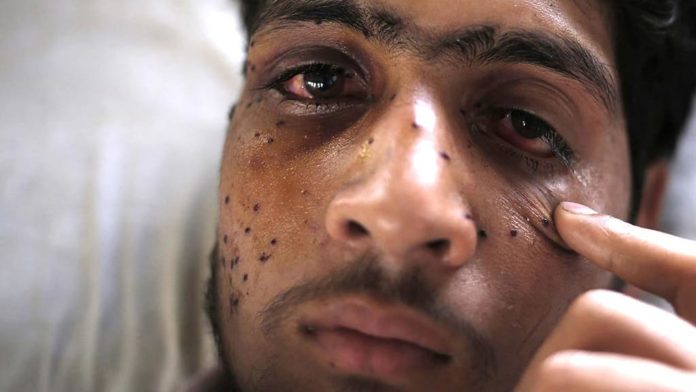 Pellet-victims