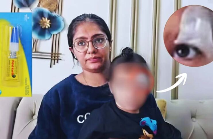 உ.பி. குழந்தையின் வெட்டுக் காயத்திற்கு ஃபெவி-குவிக் தடவிய கொடூரம்!