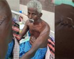 நெல்லை சேரன்மகாதேவி: ஆற்றில் குளித்ததற்காக சாதி வெறித் தாக்குதல்!