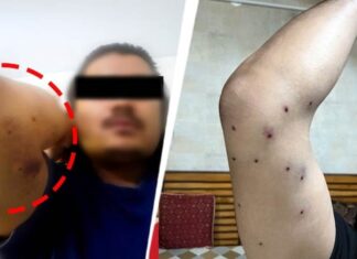 டெல்லி மாணவர் போராட்டத்தில் பெல்லட் துப்பாக்கிச்சூடு நடத்தியுள்ள கொலைகார மோடி அரசு!